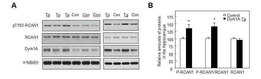 Dyrk1A TG생쥐 (TG)에서 대조군생쥐 (con)에 비해 RCAN1 인산화 증가 (A) 대표 immunoblot (B) densitometer를 사용하여 분석한 결과.