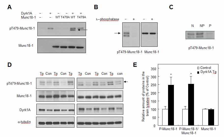 인산화 특이적 항체를 이용한 Munc18-1 T479의 in vivo 인산화 확인.