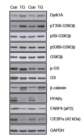 Dyrk1A Tg mice의 지방조직에서 GSK3b의 인산화 증가