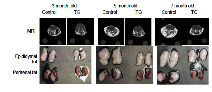 normal chow 를 공급한 3, 5, 7개월의 Dyrk1A 과발현 생쥐 (TG) 와 대조군 (WT)의 MRI와 fat content 비교