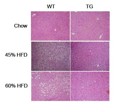 Dyrk1A Tg mice에서 고지방식이에 의한 hepatic steatosis 가 억제됨.