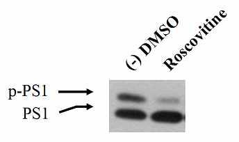 Dyrk1A 활성 저해제 screening 을 위한 cell-based assay 개발