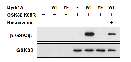 GSK3b 을 이용한 Dyrk1A 활성 저해제 screening 을 위한 in vitro assay