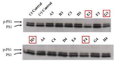 Cell-based screening 을 통한 Dyrk1A 활성 저해제 발굴