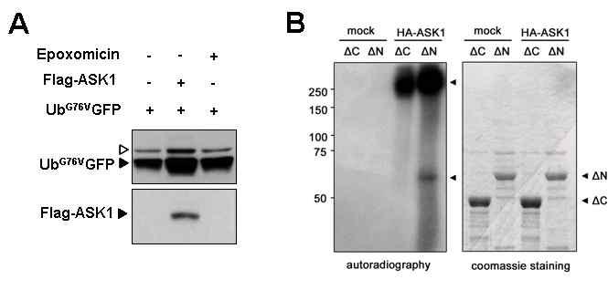 A. UbG76VGFP을 단독과 비교, UbG76VGFP + ASK1 과발현 샘플의 경우 UbG76VGFP 양이 증가됨; B. ASK1이 19S regulatory particle의 구성 단백 중 Rpt5를 in vitro에서 인산화시킴.