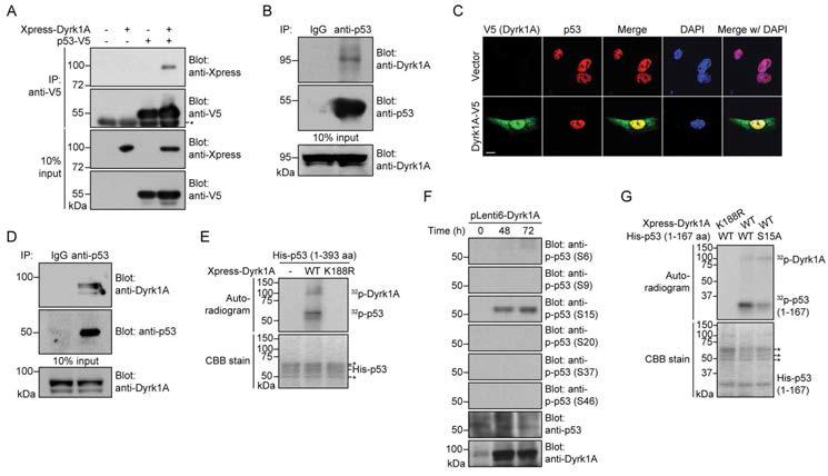 쥐 해마 신경세포주 및 전체 뇌에서의 Dyrk1A와 p53의 결합 (A-D) 및 Dyrk1A에 의한 p53 세린15의 인산화 (E-G).