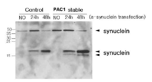 RCAN1 과발현 세포주에서의 α-synuclein의 양 변화