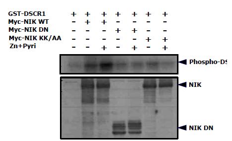 NIK는 Zn 이온에 활성화되고 RCAN1을 직접적으로 인산화시킴