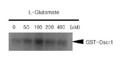 GST-fusion RCAN1과 Dyrk1A를 이용하여 in vitro 상에서 RCAN1의 인산화를 확인
