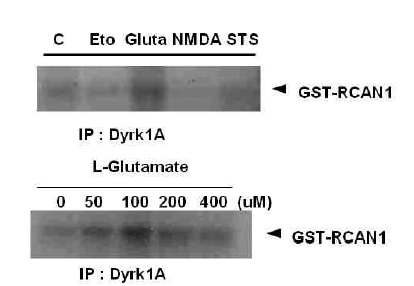 Glutamate 포함 여러 세포사멸 환경에서 Dyrk1A에 의한 RCAN1 인산화 분석