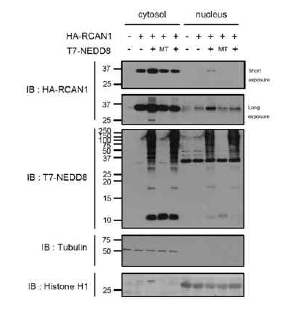 세포 구역별 분획 실험을 통한 NEDD8 수식화 후 RCAN1 단백의 발현 패턴을 분석