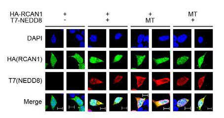 면역염색 및 형광현미경을 통한 NEDD8 수식화 후 RCAN1 단백의 발현 패턴 분석