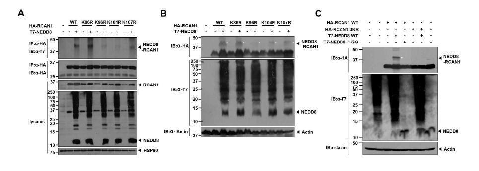RCAN1-Neddylation의 분자작용 기전 및 수식화 위치 분석