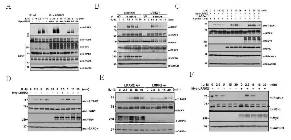 LRRK2에 의한 IL-1beta 신호전달 경로의 촉진효과 및 작용 타깃 연구