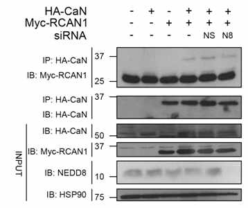NEDD8-siRNA 처리 후 RCAN1-CaN 단백 간 결합 양 변화를 측정함