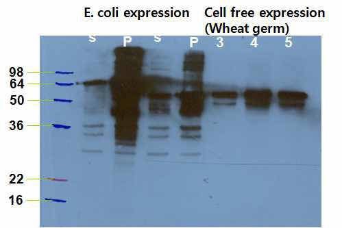 대장균과 cell-free expression system 이용한 LKB1발현