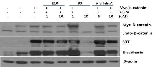 USP4의 활성을 저해하는 저해제 (E10, B7)을 in vitro assay를 통해 확보하고, 이들 저해제를 두 가지 농도로 처리하였을 때 B7의 경우 뼈대사 관련 E-cadherin의 발현을 조절한다는 것을 확인함