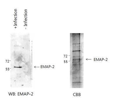 Baculovirus expression system을 이용하여, EMAP-2를 생산함.