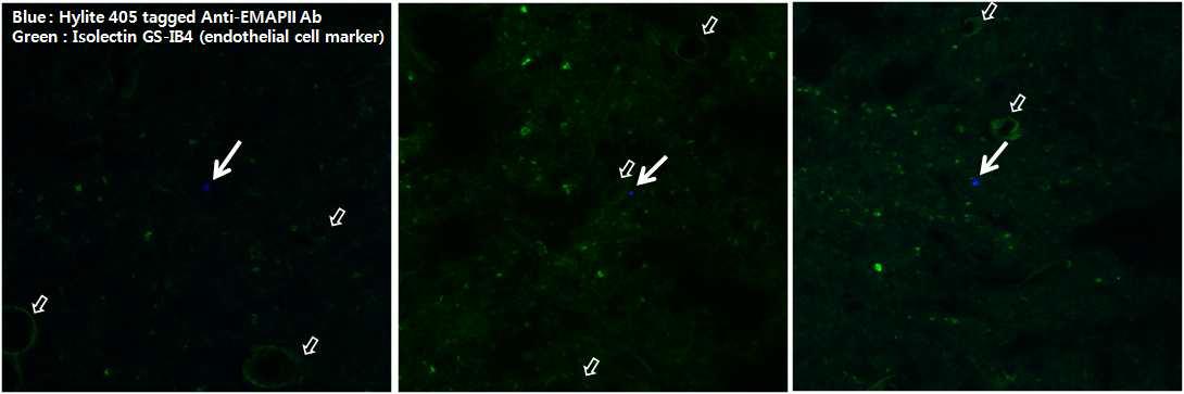 Rat에 형광이 부착된 EMAP-2 항체를 주사한 후, 24시간 이후 brain 절편을 만들어 항체의 뇌실내 존재 여부를 조사