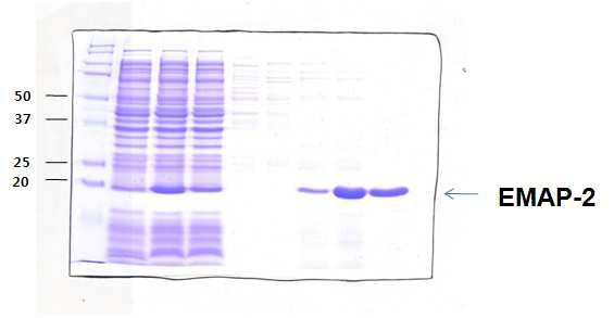 His-purification을 이용하여 bacteria에 발현된 EMAP-2를 분리 정제함