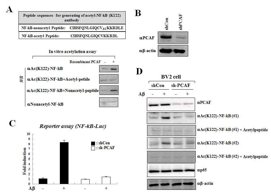 Aβ 매개 NF-kB 아세틸화와 활성화 시 PCAF의 역할 검토