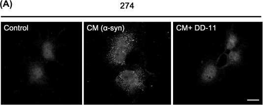 α-synuclein의 dynamin에 의한 세포내 이입과정