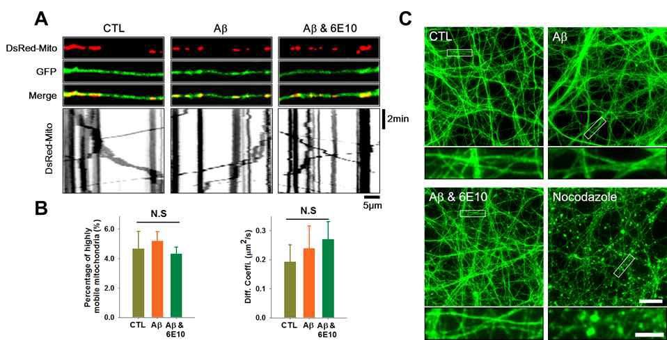 Aβ에 의한 미토콘드리아의 움직임, microtubule 구조변화