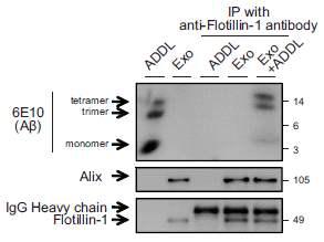 anti-Flotillin-1 항체를 통한 Aβ의 침착반응