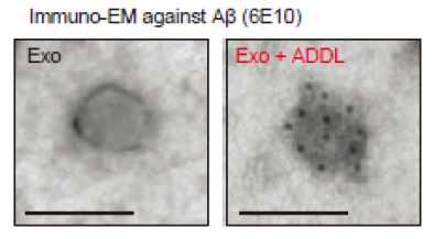 anti-Aβ 항체를 통한 exosome과 Aβ 결합 검증 (scale bar 100 nm)