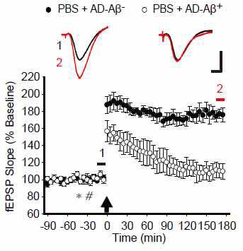 Aβ를 포함에 따른 AD brain 추출물의 효과를 확인하기 위하여 LTP 유도 (화살표) 45분 전 PBS 5ul (*)를 주입, 30분 전에 AD-Aβ+ (6ul) 혹은 AD-Aβ- (6 ul)를 각각 주입 (#), Aβ를 포함한 Mock ID-AD group에서 특이적으로 LTP의 저해가 일어남을 확인함