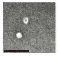 human CSF에서 추출해 낸 exosome 이미지 (Electron Microscopy), Scale 500 nm