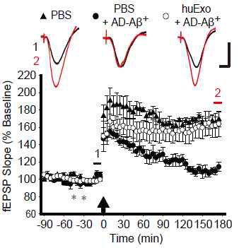 Human CSF-derived exosome (huExo)의 AD-brain derived Aβ oligomer (AD-Aβ+)에 의한 시냅스 독성에 미치는 영향