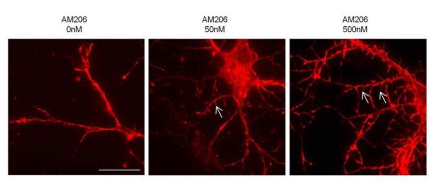 Low-power field view of primary neurons cultured from Tg2576 mice