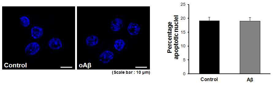 oAβ treatment가 cell death에 미치는 영향