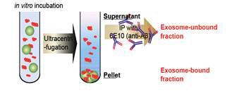 in vitro Aβ, exosome binding assay 모식도