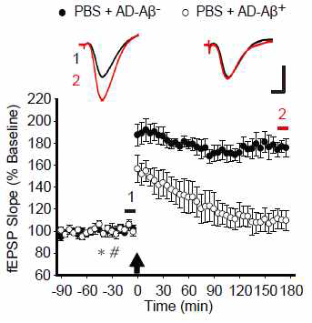 Aβ를 포함에 따른 AD brain 추출물의 효과를 확인하기 위하여 LTP 유도 (화살표) 45분 전 PBS 5ul (*)를 주입, 30분 전에 AD-Aβ+ (6ul) 혹은 AD-Aβ- (6 ul)를 각각 주입 (#), Aβ를 포함한 Mock ID-AD group에서 특이적으로 LTP의 저해가 일어남을 확인함.