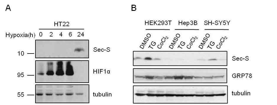 Hypoxia(A), ER stress(B) 상황에서 Sec-S의 발현 증가