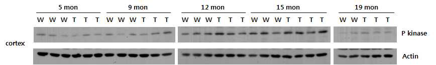 TG2576 mouse brain에서 P kinase 발현 pattern