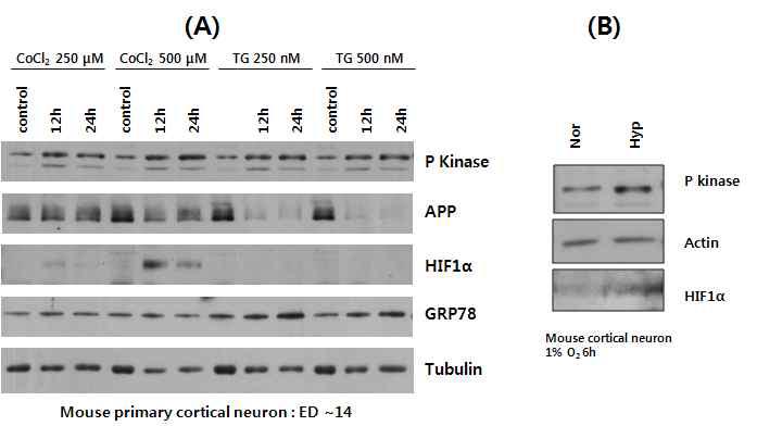 다양한 조건에서 P-kinase 발현