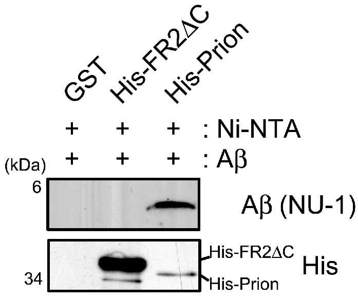 Prion 단백질과 Oligomeric Aβ와의 결합