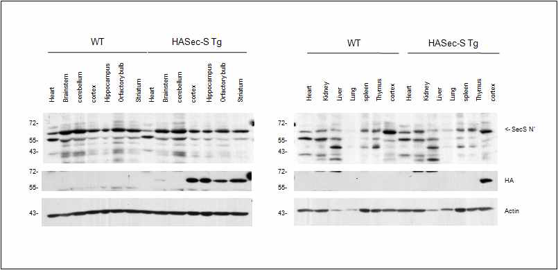 HASec-S Tg mouse의 조직별 발현 확인