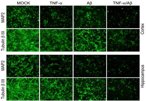 TNF-α에 의한 Aβ neurotoxicity 증가