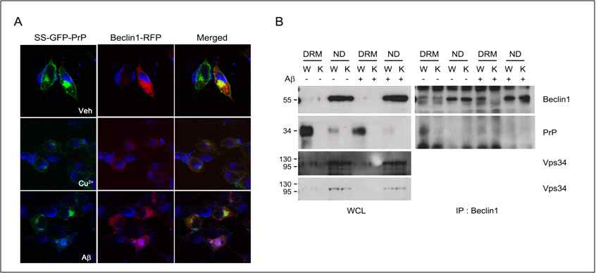 Aβ에 의한 PRNP단백질의 세포내로의 endocytosis를 형광현미경(A) 및 웨스턴 블랏(B)으로 관찰