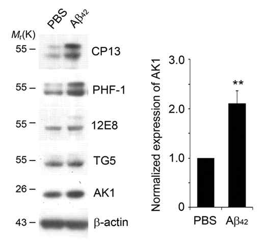 mouse cortical neuron에 Aβ42 처리 후 western blotting