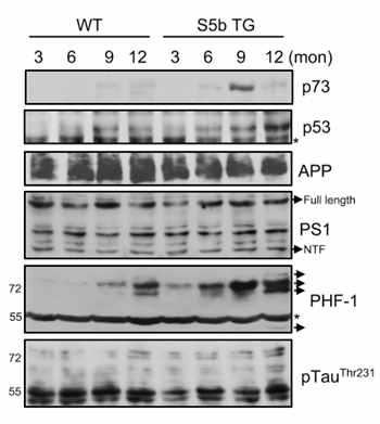 PSMD5/S5b transgenic mice에서 Tau의 변화