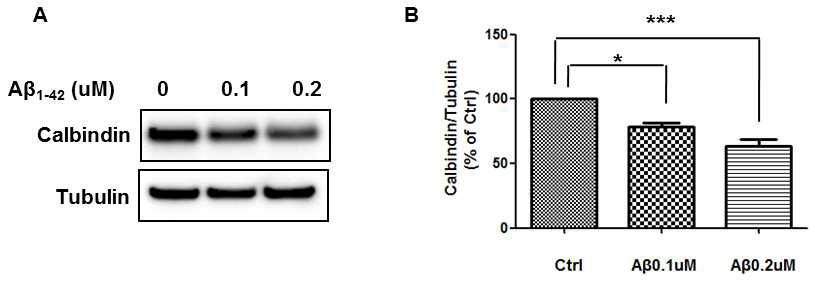 일차신경세포에서 Aβ oligomer 처리에 의한 calbindin 단백질 발현 감소