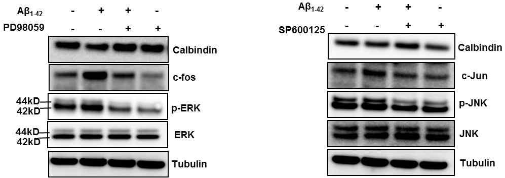 Aβ oligomer 처리에 의한 calbindin 단백질 발현 감소가 ERK 또는 JNK 신호를 통해 일어남