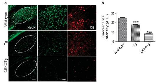 CBKOTg에서 신경세포의 감소 확인.