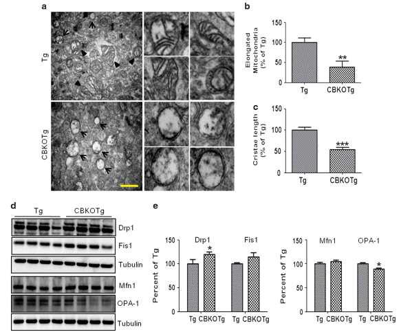 CBKOTg에서의 미토콘드리아 구조와 주요단백질의 변화.