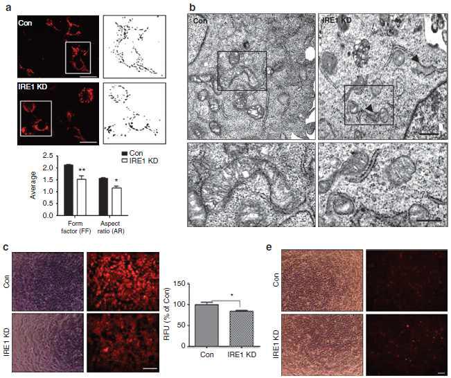 IRE1 knockdown cell에서 보이는 미토콘드리아의 기능 상실